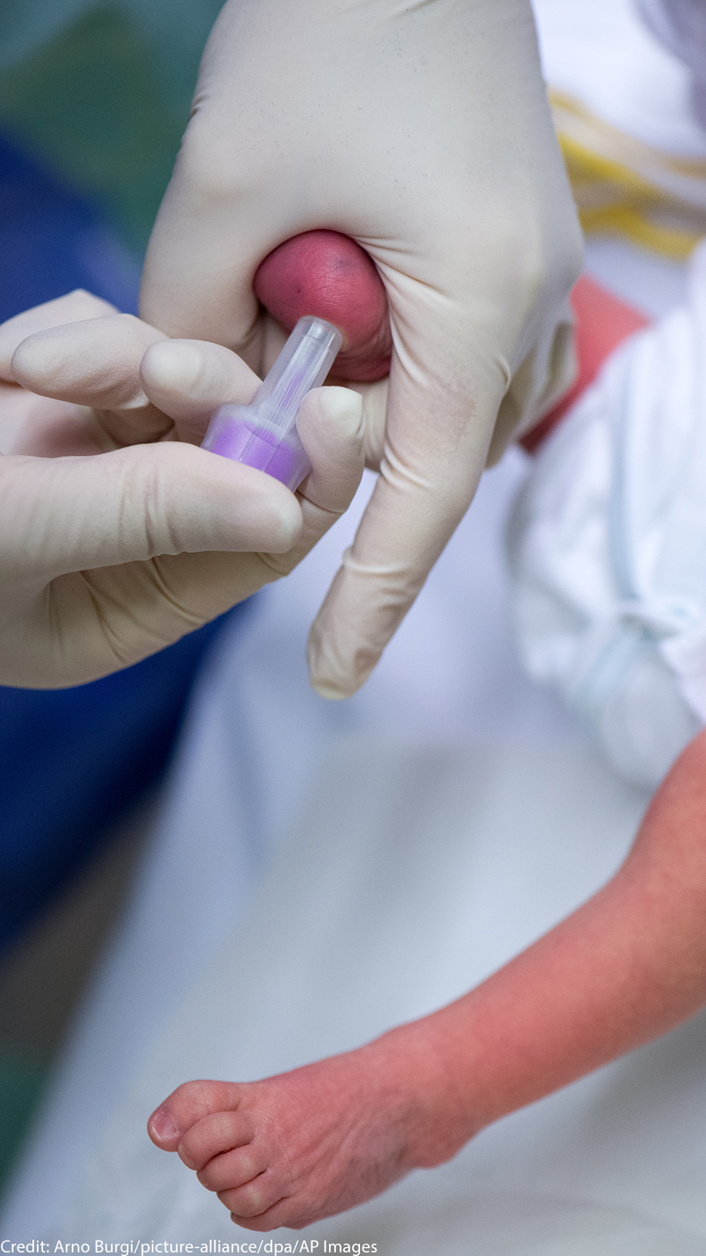 A newborn has its blood drawn from to test for genetic diseases.